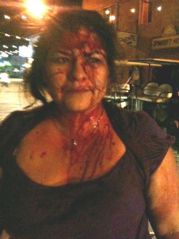 Police Brutality in San Pedro (3)