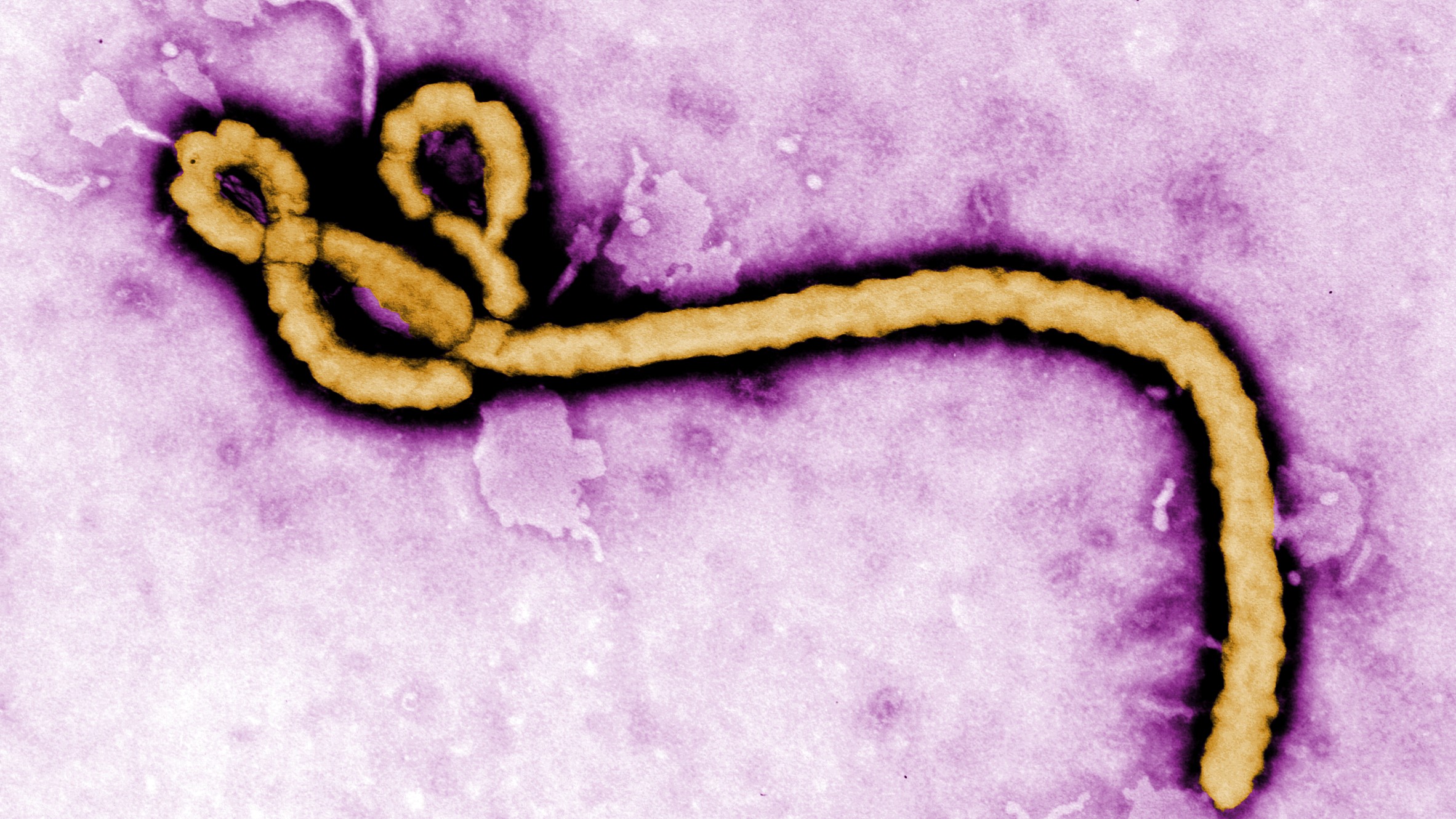 Ministry of Health and Wellness Advisory on Ebola